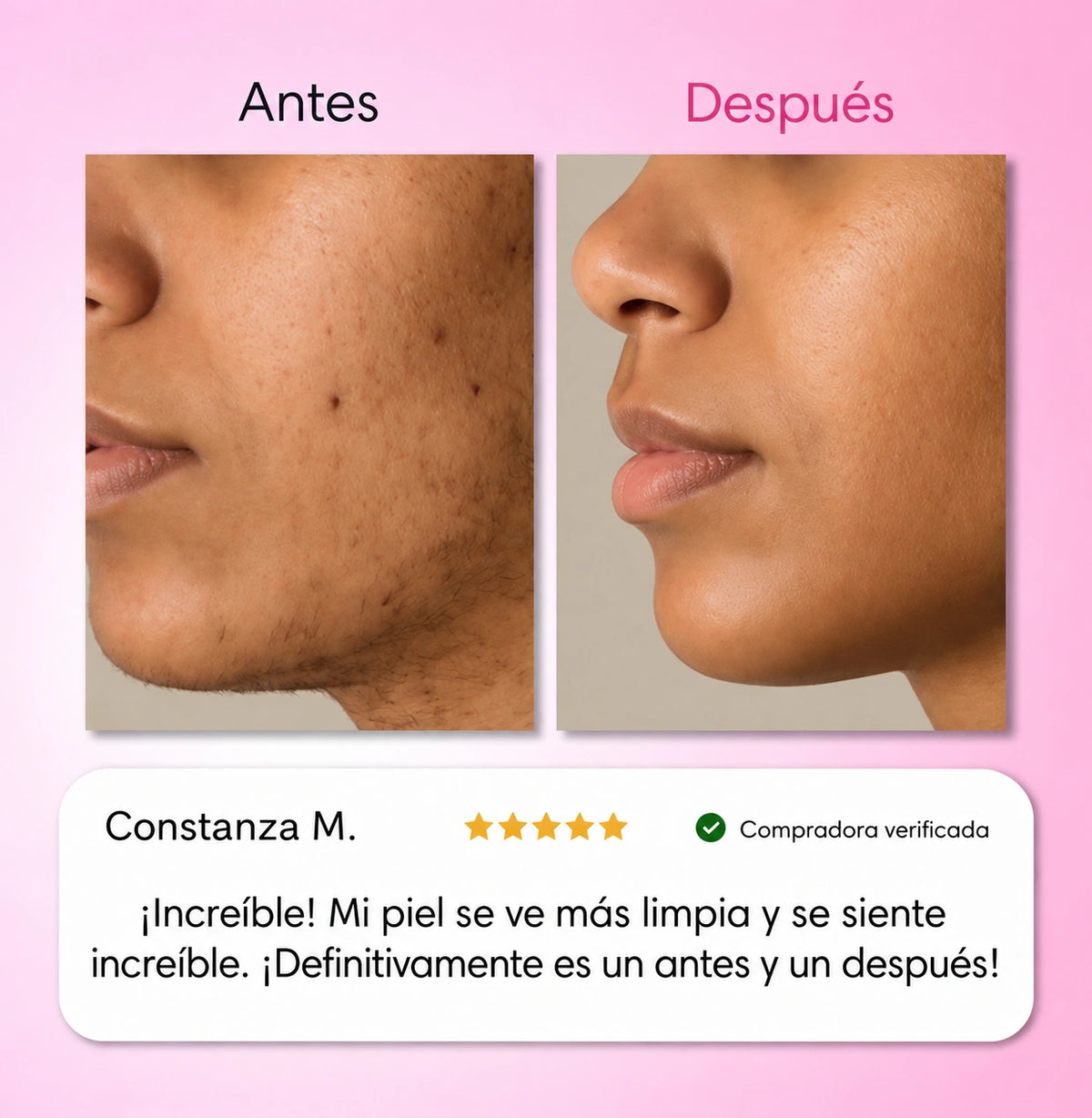 Kit de Depilacion 3 Pasos Smooth 3