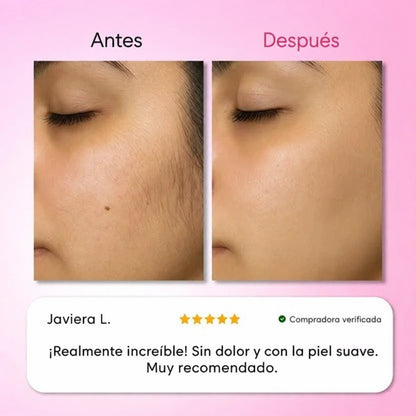 Kit de Depilacion 3 Pasos Smooth 3