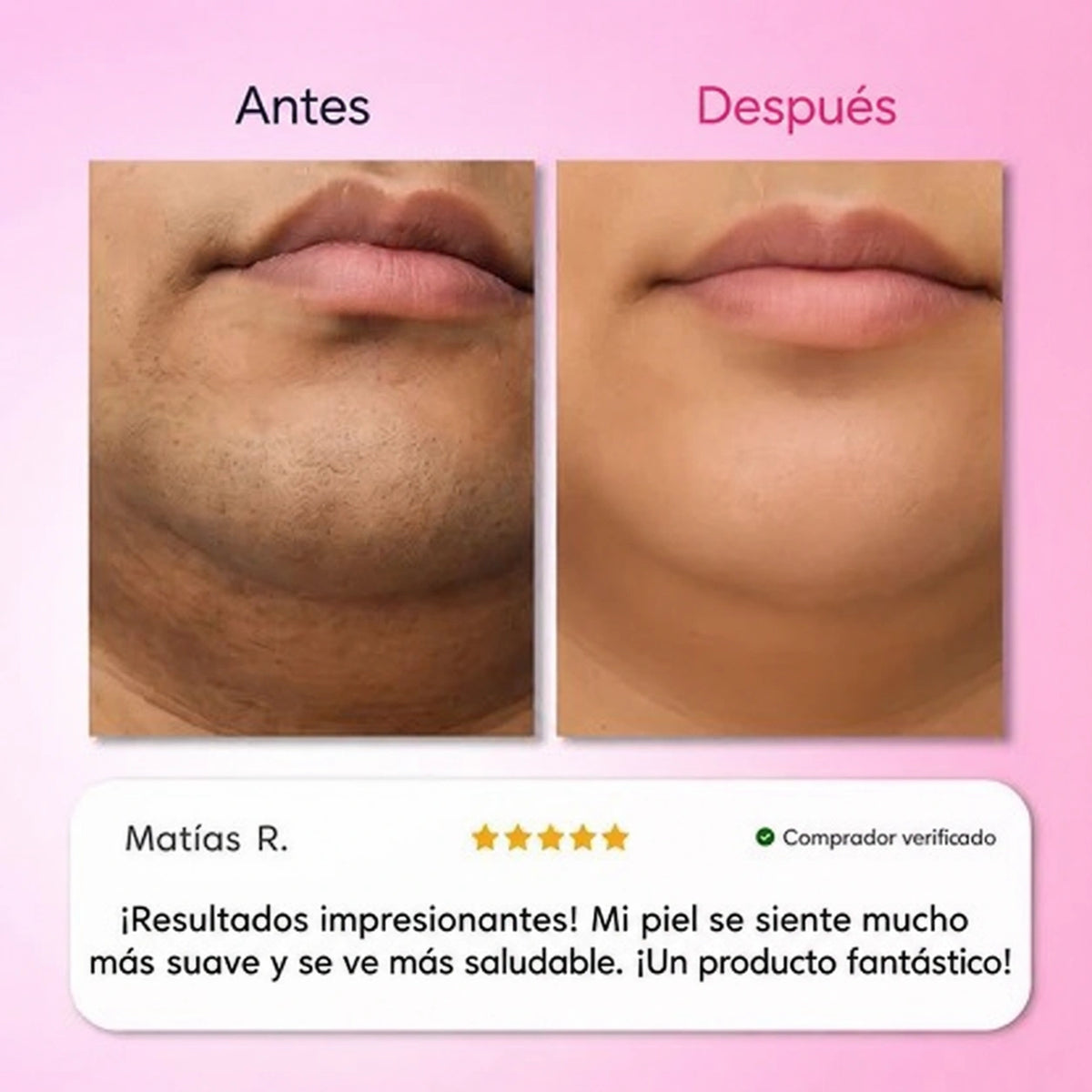 Kit de Depilacion 3 Pasos Smooth 3