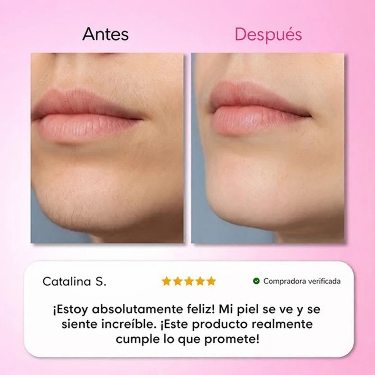 Kit de Depilacion 3 Pasos Smooth 3