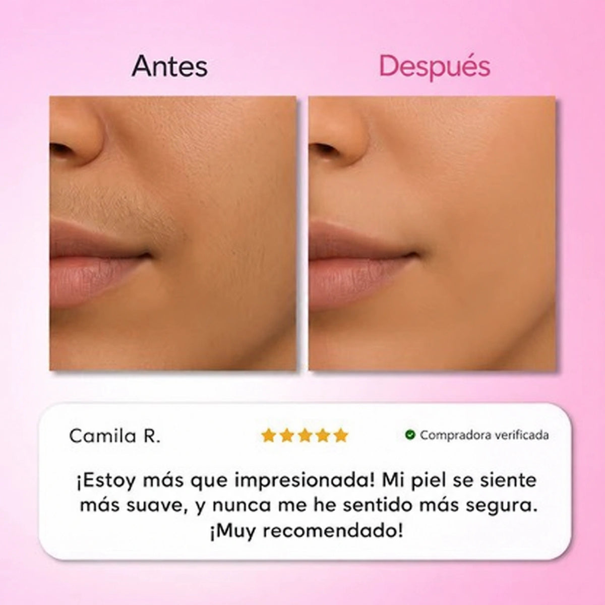 Kit de Depilacion 3 Pasos Smooth 3